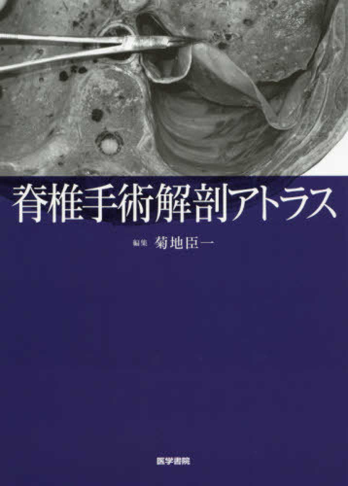 脊椎手術解剖アトラス 編集 菊池臣一 脊椎手術解剖アトラス 編集 菊池臣一