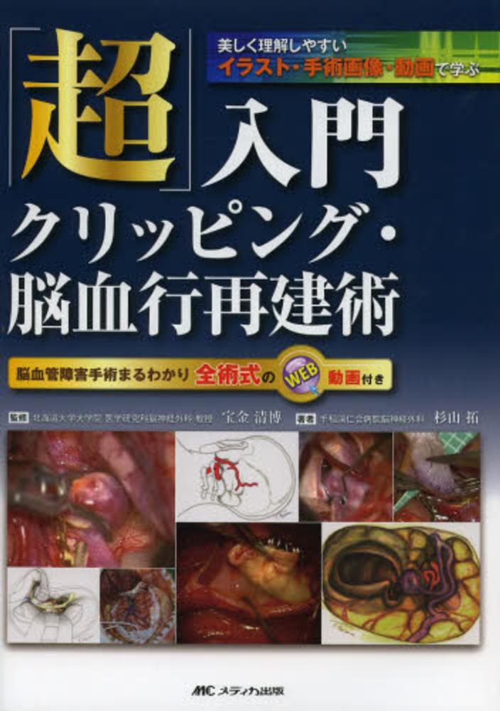 Books Kinokuniya: 「超」入門クリッピング・脳血行再建術－美しく理解