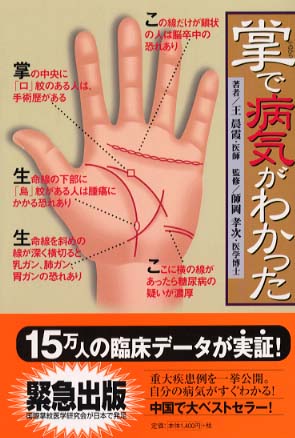 Books Kinokuniya: 掌で病気がわかった / 王晨霞 師岡孝次 (9784907710934)
